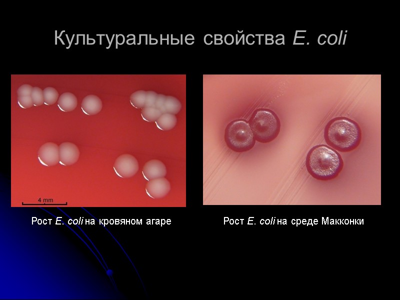Культуральные свойства E. coli Рост E. coli на кровяном агаре Рост E. coli на